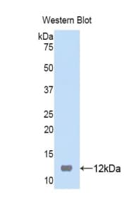 PI3 / Elafin Antibody (aa41-117, Biotin)