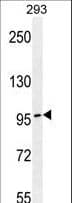 TCERG1 / CA150 Antibody (aa991-1020)