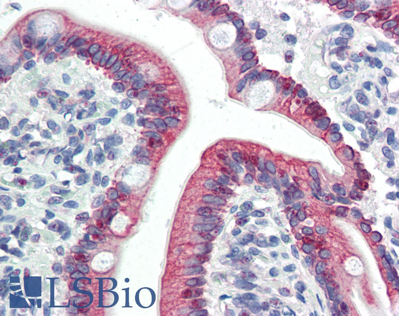 IHC-plus™ LASS5 Antibody