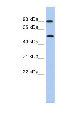 PRMT7 Antibody (N-Terminus)