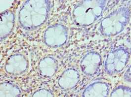 Polyclonal Rabbit anti-Human AZU1 / Azurocidin Antibody (aa27-251, IHC, WB)