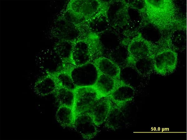LAMB3 / Laminin Beta 3 Antibody (clone 2G10)