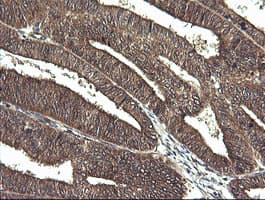 CTAG1B / NY-ESO-1 Antibody (clone OTI4C12)