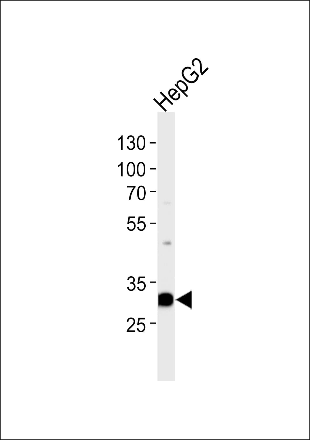 PSME2 Antibody (aa61-91)