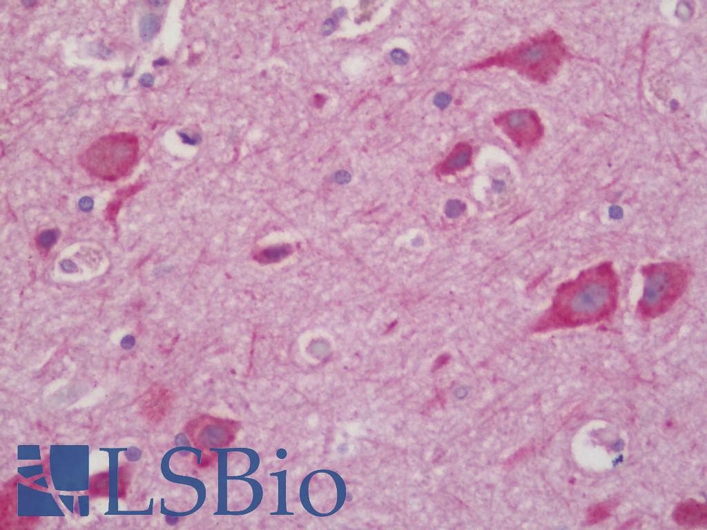 IHC-plus™ RPSA / Laminin Receptor Antibody (aa166-215)