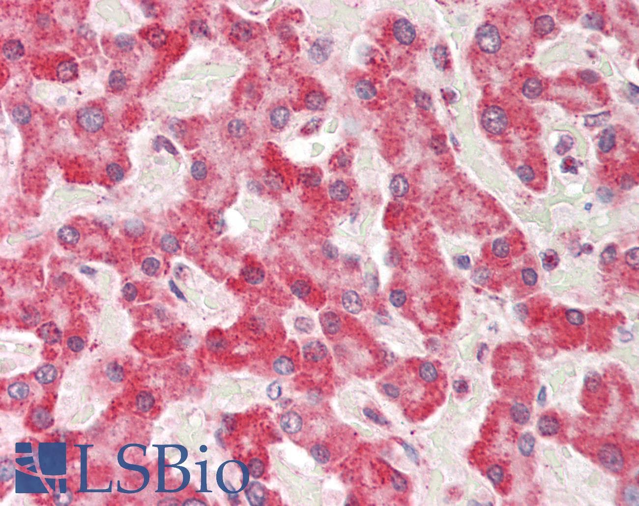 Polyclonal Rabbit anti-Human ABAT Antibody (aa290-339, IHC, WB)