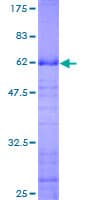 Human ING2 Protein (Recombinant GST)