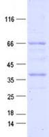 Human KDR / VEGFR2 / FLK1 Protein (Recombinant DDK,C-terminus)