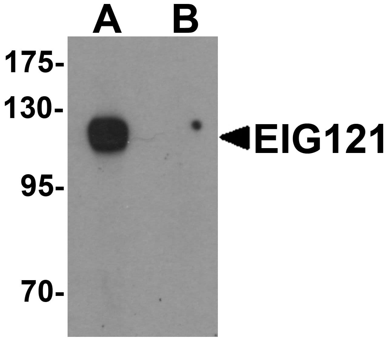 IHC-plus™ Polyclonal Rabbit anti-Human KIAA1324 / maba1 Antibody (IHC, IF, WB)