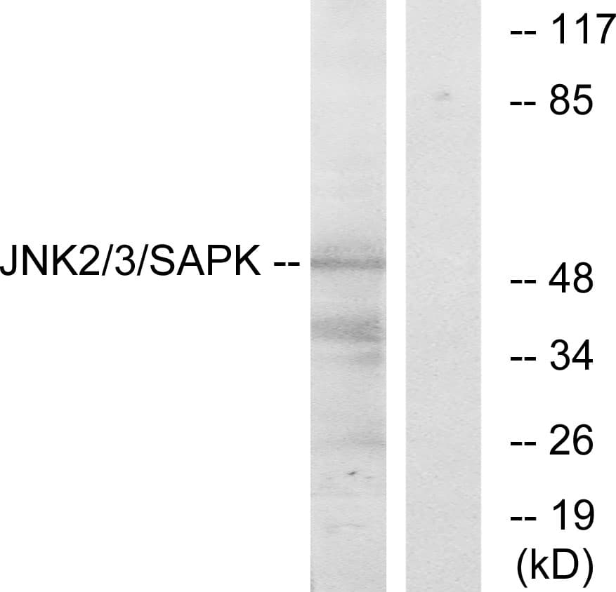 JNK1+2+3 Antibody (Internal)
