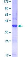 Human GNA14 Protein (Recombinant GST, N-terminus)