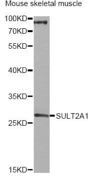 Polyclonal Rabbit anti-Human SULT2A1 / Sulfotransferase 2A1 Antibody (IHC, WB)
