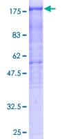 Human HDAC6 Protein (Recombinant GST)
