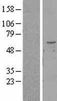 Human TMPRSS2 / Epitheliasin Protein (Over-Expression Lysate Myc-DDK (Flag))
