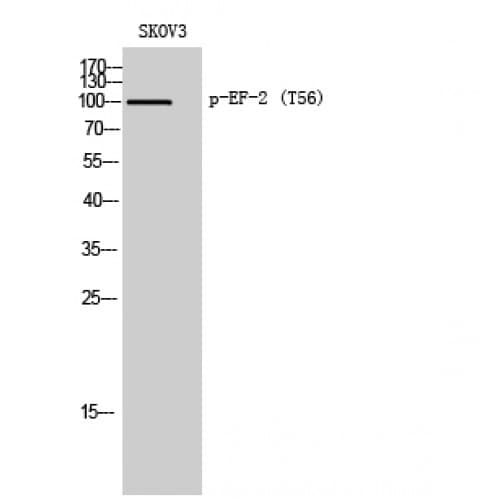 Polyclonal Rabbit anti-Human EEF2 / Elongation Factor 2 Antibody (1-80 aa, IHC, IF, WB)