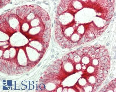 IHC-plus™ KRT16 / CK16 / Cytokeratin 16 Antibody (clone 7A4)