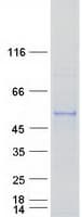 Human CYP2S1 Protein (Recombinant Myc-DDK (Flag))