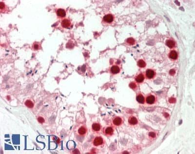 IHC-plus™ PCNA Antibody (aa177-189)