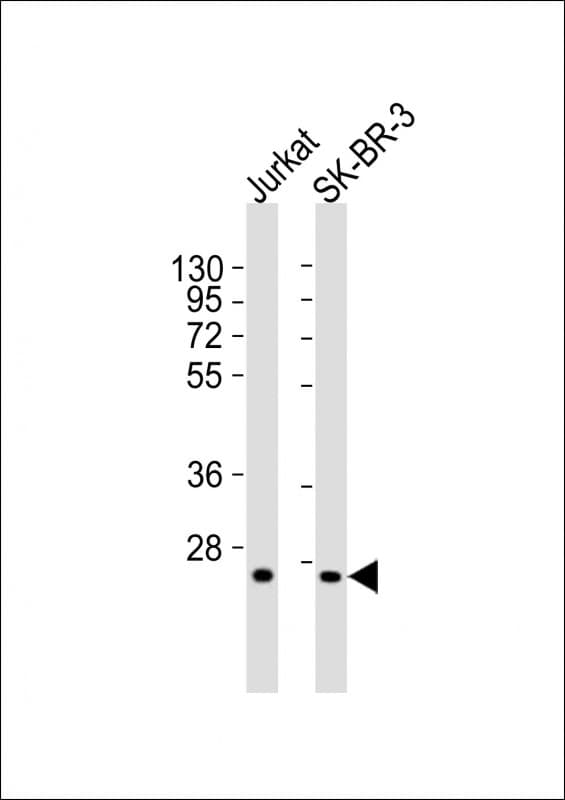 GZMK / Granzyme K Antibody (aa87-121)