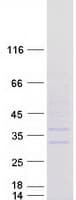 Human ABHD14A Protein (Recombinant Myc-DDK (Flag))
