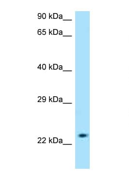 Polyclonal Rabbit anti-Human SLC50A1 / SCP Antibody (aa139-188, WB)