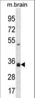 Polyclonal Rabbit anti-Human STX2 / Syntaxin 2 Antibody (aa123-152, IHC, WB)