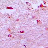 Polyclonal Rabbit anti-Human ER81 / ETV1 Antibody (N-Terminus, IHC, WB)