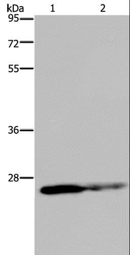 Polyclonal Rabbit anti-Human GSTP1 / GST Pi Antibody (IHC, WB)
