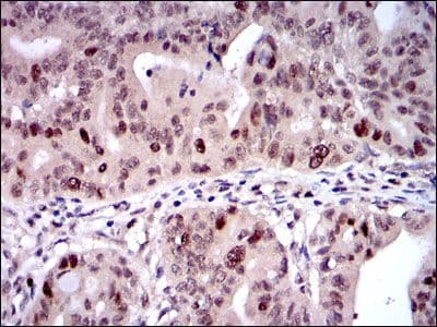 KIF22 / OBP Antibody (clone 1000)