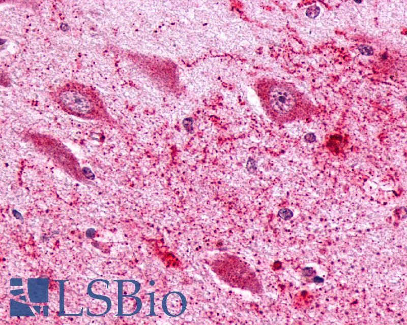 IHC-plus™ Polyclonal Rabbit anti-Human PTGER3 / EP3 Antibody (Cytoplasmic Domain, IHC)