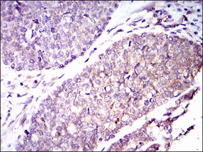 GUCY1A1 / GUCY1A3 Antibody (aa22-214, clone 3G6B2)