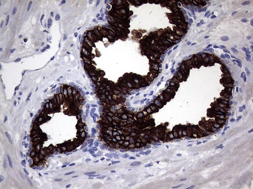 KRT18 / CK18 / Cytokeratin 18 Antibody (aa69-372, clone OTI10G8)