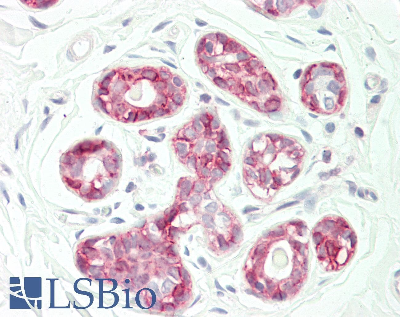 IHC-plus™ Polyclonal Rabbit anti-Human KANSL3 Antibody (aa398-427, IHC, WB)