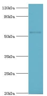 CYP2F / CYP2F1 Antibody (aa100-290)