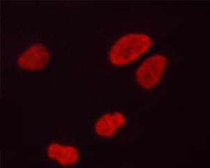 Polyclonal Rabbit anti-Human ATXN1 / SCA1 Antibody (phospho-Ser775, IF, WB)