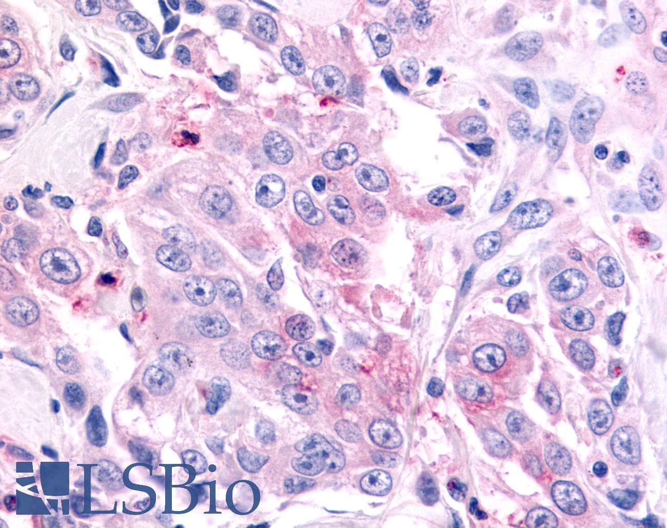 PathPlus™ Polyclonal Rabbit anti-Human NR6A1 / GCNF Antibody (Ligand-binding Domain, IHC)
