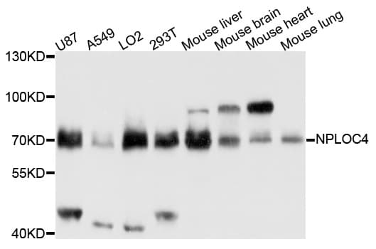 Polyclonal Rabbit anti-Human NPLOC4 Antibody (WB)