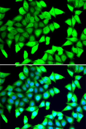 HDAC5 Antibody