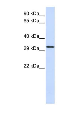 C21orf2 Antibody (N-Terminus)