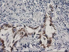 FGFR2 / FGF Receptor 2 Antibody (clone OTI1H5)