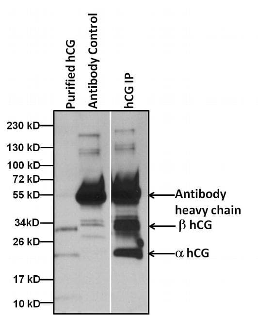 Monoclonal Mouse anti-Human hCG / Chorionic Gonadotropin Antibody (clone 3002, IHC)
