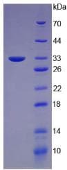 Mouse KRT5 / CK5 / Cytokeratin 5 Protein (Recombinant His)