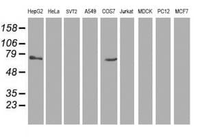 TBC1D21 Antibody (clone OTI3F1)
