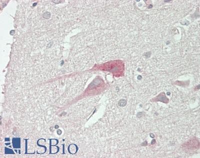IHC-plus™ MAP3K13 / LZK Antibody (aa166-205)
