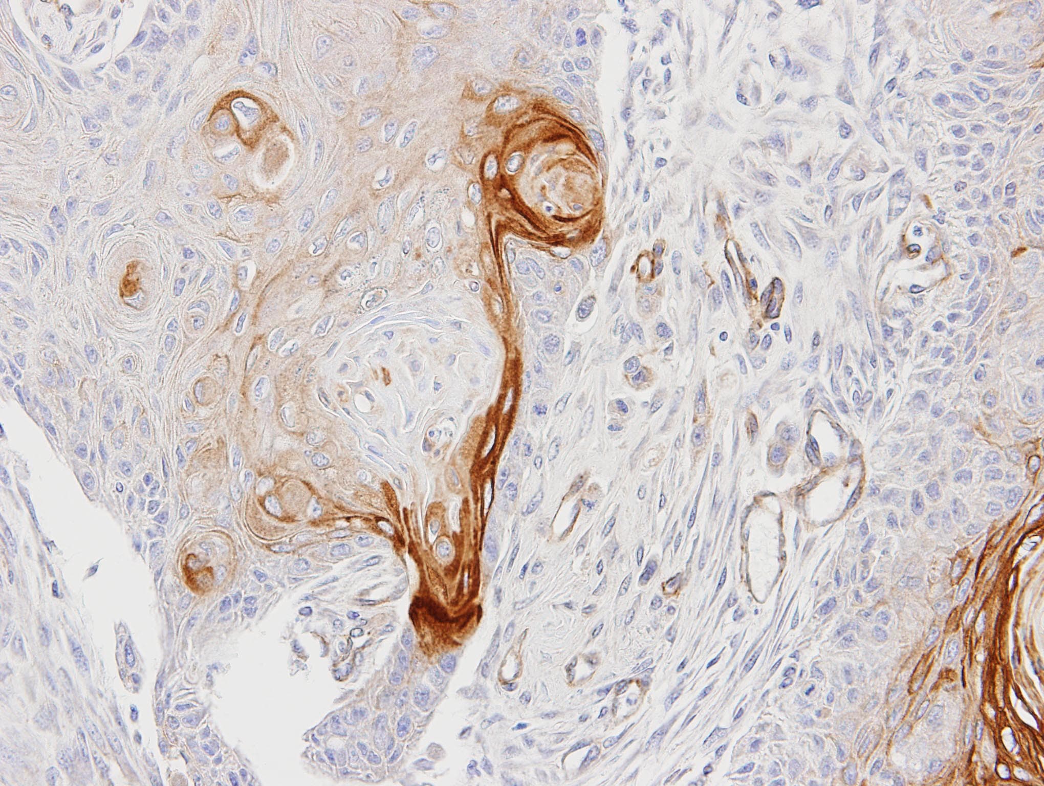 ENTPD6 Antibody (aa114-285)