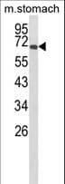Polyclonal Rabbit anti-Human GLIS1 Antibody (aa133-161, IHC, WB)