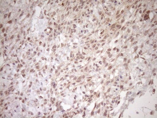 Monoclonal Mouse anti-Human TCP10 Antibody (clone OTI2C2, IHC, WB)