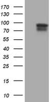 Paraplegin / SPG7 Antibody (clone OTI3H10)
