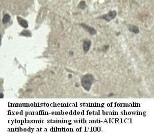 Polyclonal Rabbit anti-Human DDH / AKR1C1 Antibody (aa2-218, IHC, WB)