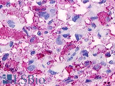 PathPlus™ Polyclonal Rabbit anti-Human GPR119 Antibody (Cytoplasmic Domain, IHC)